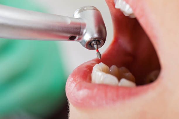 Best Weekend Emergency Dentist in Fredericktown, MO